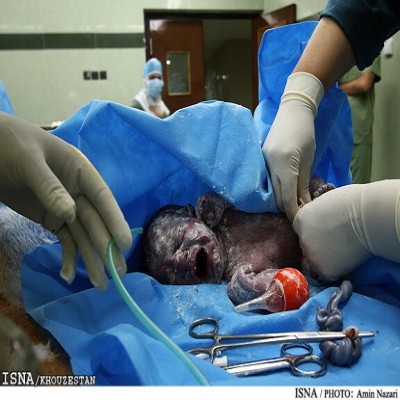 لزوم اصلاح معایب قانون «جوانی جمعیت»/ فرصت یک هفته‌ای؛ ناکافی برای صدور جواز سقط