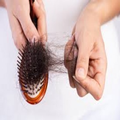 همه انچه درمورد قطع ریزش مو