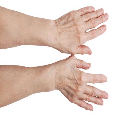 2 تمرین ساده برای درمان آرتروز دست در خانه